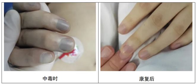 一口下肚老人中毒变“紫”这道家常菜很多人爱吃！(图2)